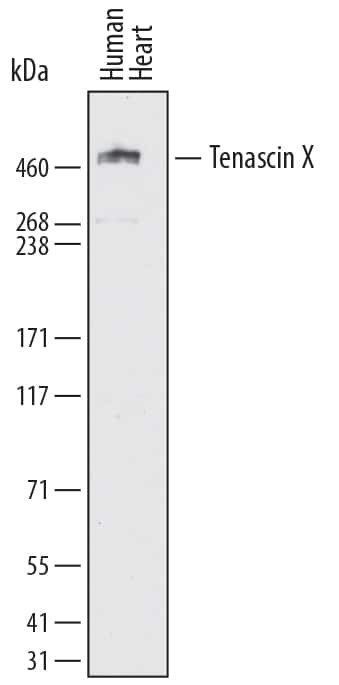 TNXB Antibody in Western Blot (WB)
