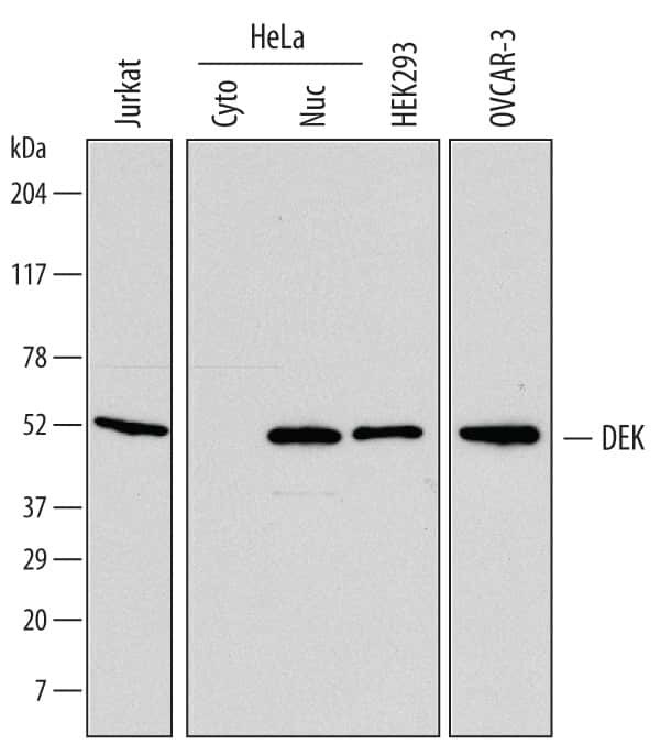DEK Antibody in Western Blot (WB)
