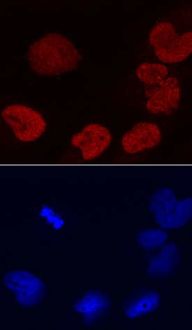 DEK Antibody in Immunocytochemistry (ICC/IF)