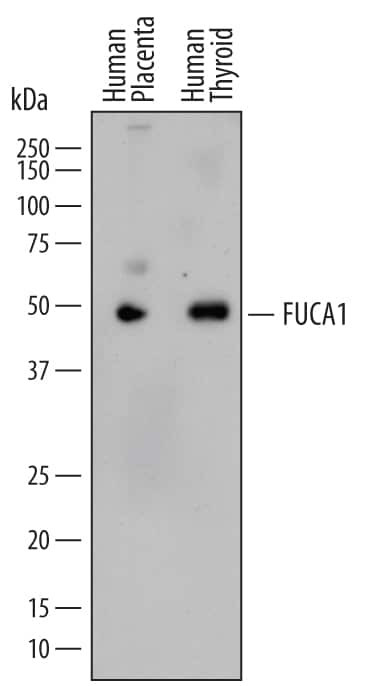 FUCA1 Antibody in Western Blot (WB)
