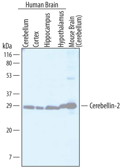 Cerebellin 2 Antibody in Western Blot (WB)