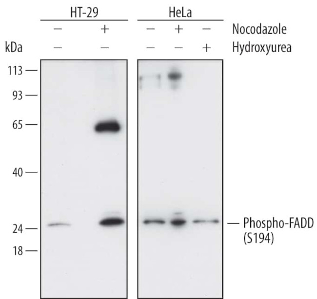 Phospho-FADD (Ser194) Antibody in Western Blot (WB)