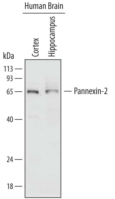 Pannexin 2 Antibody in Western Blot (WB)