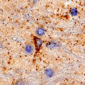 KATNA1 Antibody in Immunohistochemistry (Paraffin) (IHC (P))