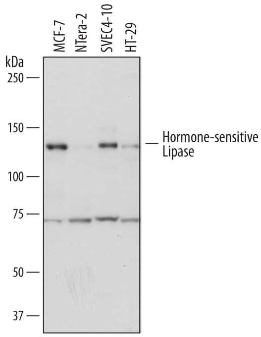 HSL Antibody in Western Blot (WB)