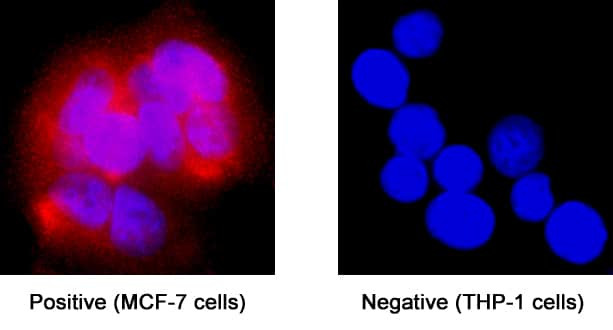 Estrogen Receptor beta Antibody in Immunocytochemistry (ICC/IF)