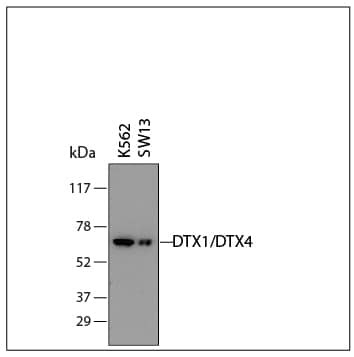 DTX1/DTX4 Antibody in Western Blot (WB)