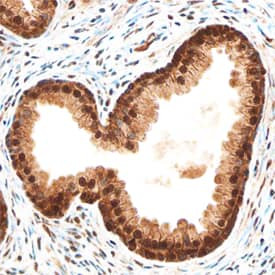 MKP-1 Antibody in Immunohistochemistry (Paraffin) (IHC (P))