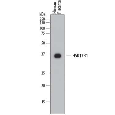 HSD17B1 Antibody in Western Blot (WB)