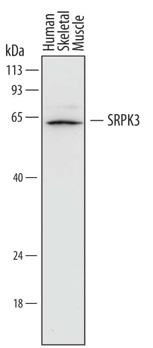 SRPK3 Antibody in Western Blot (WB)