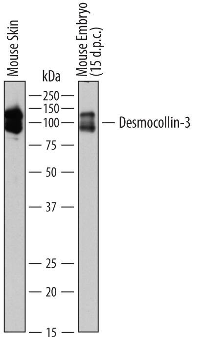 Desmocollin 3 Antibody in Western Blot (WB)