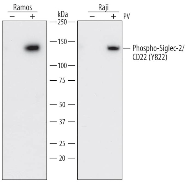 Phospho-CD22 (Tyr822) Antibody in Western Blot (WB)