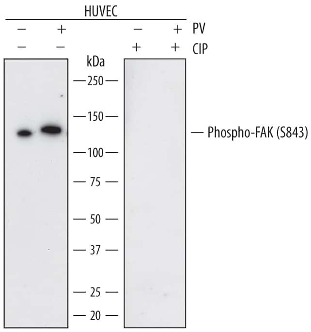 Phospho-FAK (Ser843) Antibody in Western Blot (WB)