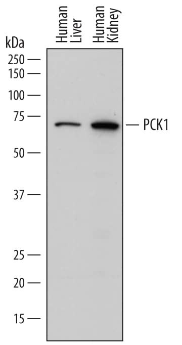 PCK1 Antibody in Western Blot (WB)