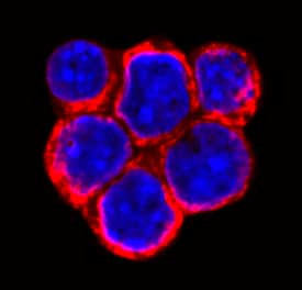 SLITRK6 Antibody in Immunocytochemistry (ICC/IF)