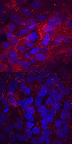 Laminin alpha-4 Antibody in Immunocytochemistry (ICC/IF)