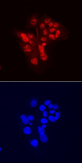 CHD7 Antibody in Immunocytochemistry (ICC/IF)