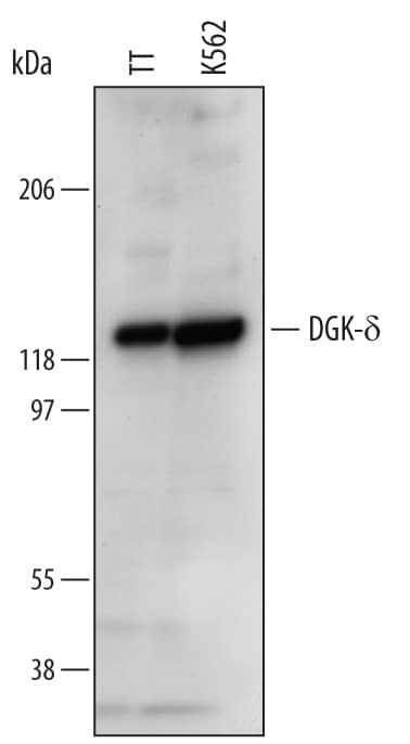 DGKD Antibody in Western Blot (WB)