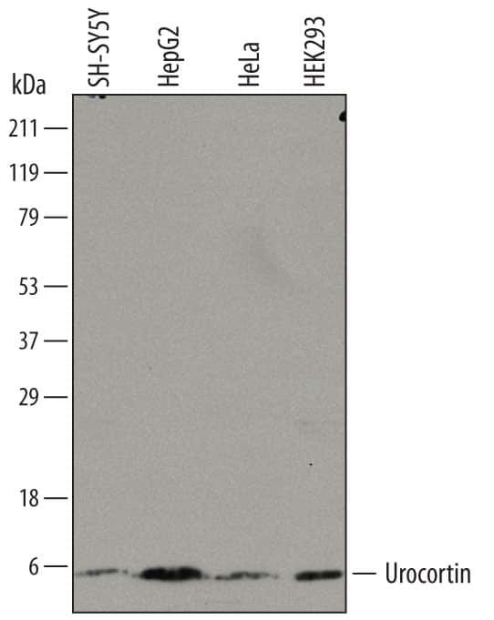 Urocortin Antibody in Western Blot (WB)