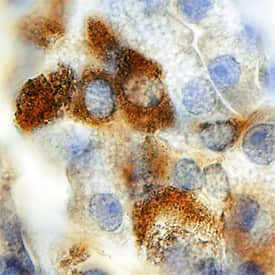 CHST3 Antibody in Immunohistochemistry (Paraffin) (IHC (P))