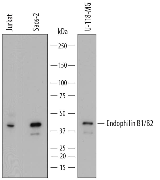 Endophilin B1/B2 Antibody in Western Blot (WB)