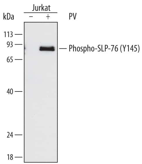 Phospho-SLP76 (Tyr145) Antibody in Western Blot (WB)