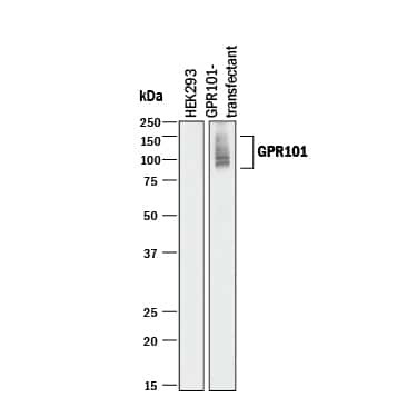 GPR101 Antibody in Western Blot (WB)