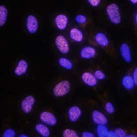 EVI1 Antibody in Immunocytochemistry (ICC/IF)