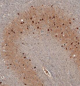 HSD17B14 Antibody in Immunohistochemistry (Paraffin) (IHC (P))