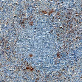 EDG3 Antibody in Immunohistochemistry (Paraffin) (IHC (P))