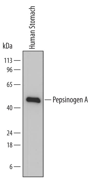 Pepsinogen I Antibody in Western Blot (WB)