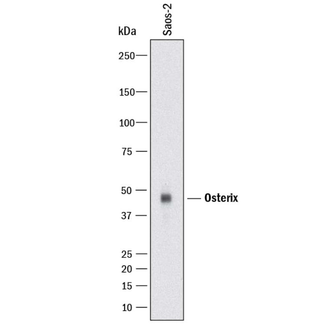 SP7 Antibody in Western Blot (WB)