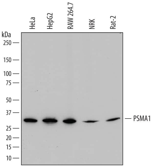 PSMA1 Antibody in Western Blot (WB)