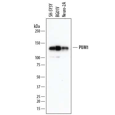 PUM1 Antibody in Western Blot (WB)