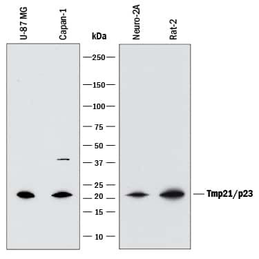 TMP21 Antibody in Western Blot (WB)