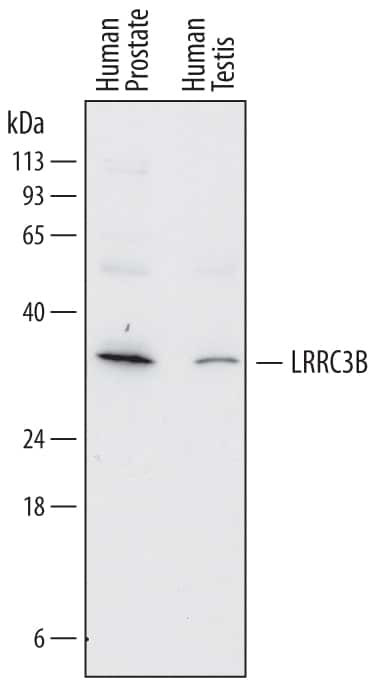 LRP15 Antibody in Western Blot (WB)