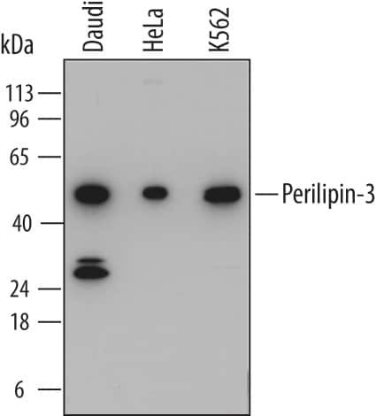 TIP47 Antibody in Western Blot (WB)