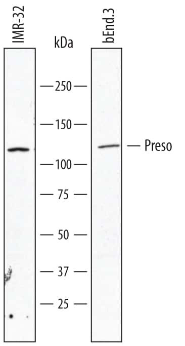 FRMPD4 Antibody in Western Blot (WB)