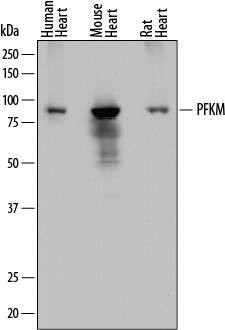 PFKM Antibody in Western Blot (WB)