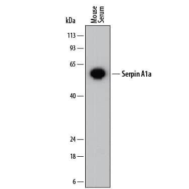alpha-1 Antitrypsin Antibody in Western Blot (WB)