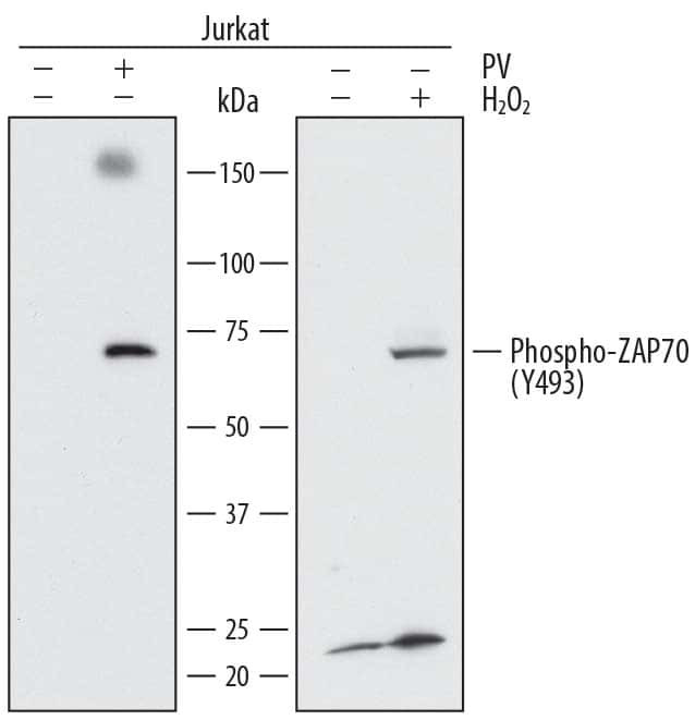 Phospho-Zap-70 (Tyr493) Antibody in Western Blot (WB)