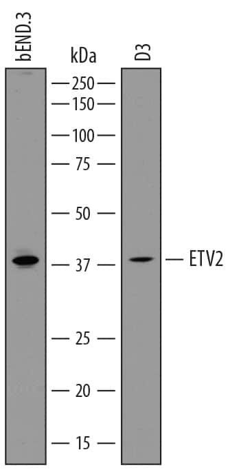 ETV2 Antibody in Western Blot (WB)