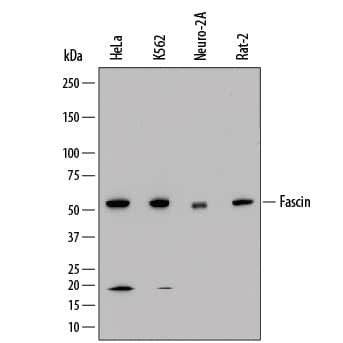 Fascin Antibody in Western Blot (WB)