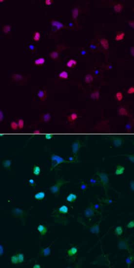 SOX6 Antibody in Immunocytochemistry (ICC/IF)