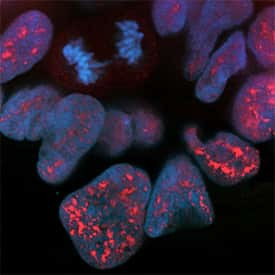 Phospho-BAD (Ser99) Antibody in Immunocytochemistry (ICC/IF)