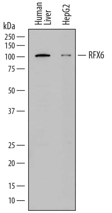RFX6 Antibody in Western Blot (WB)