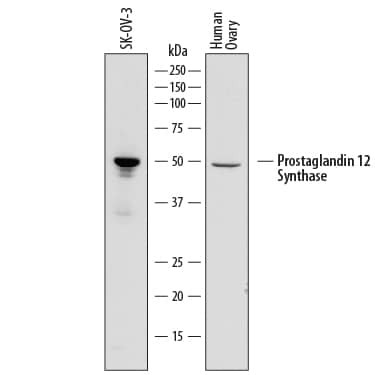 PTGIS Antibody in Western Blot (WB)