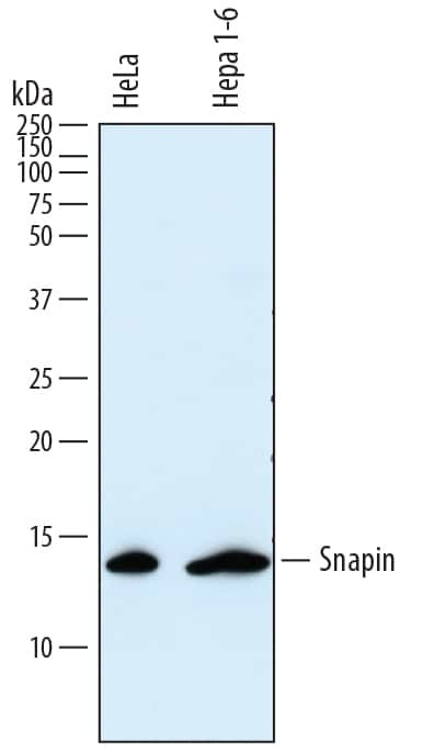 SNAPAP Antibody in Western Blot (WB)