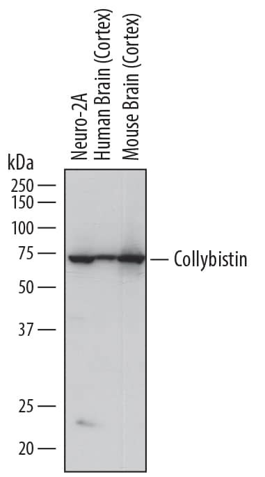 ARHGEF9 Antibody in Western Blot (WB)