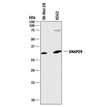 SNAP29 Antibody in Western Blot (WB)